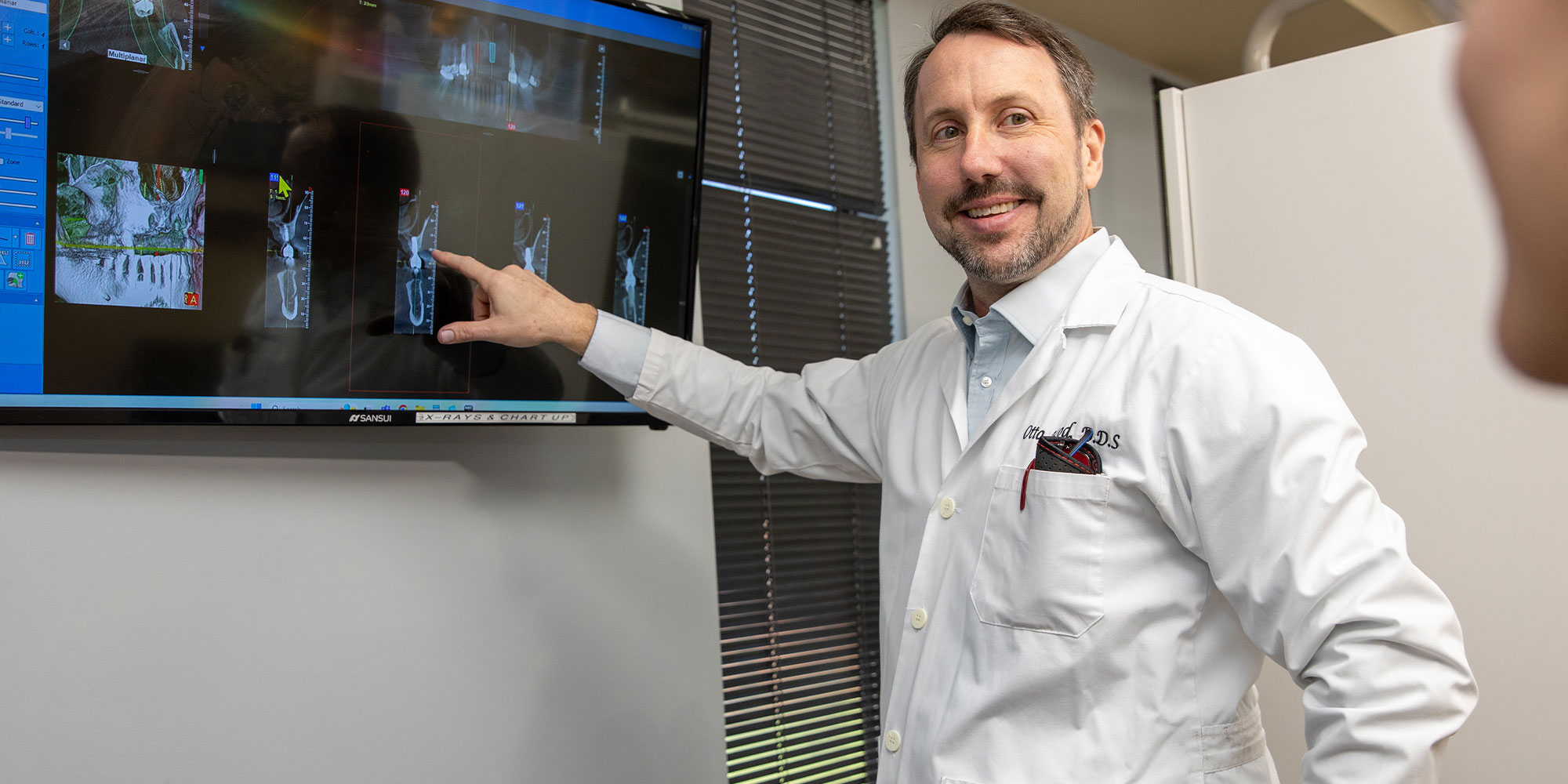 Doctor Going over dental X-ray with Patient