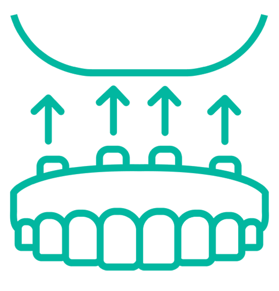 full arch dental implant icon